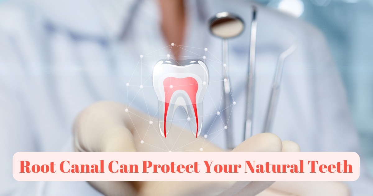 how a root canal can protect your natural teeth